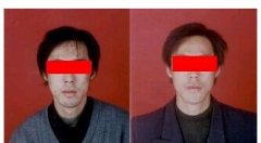 呼和浩特肤康皮肤病专科