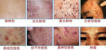呼和浩特肤康皮肤病专科